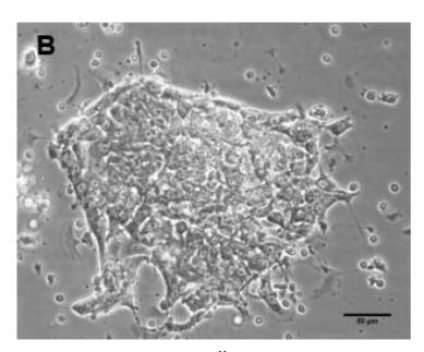 Figure 1B