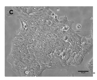 Figure 1C