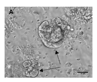 Figure 1A
